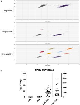 Oral Microbiome Dysbiosis Is Associated With Symptoms Severity and Local Immune/Inflammatory Response in COVID-19 Patients: A Cross-Sectional Study